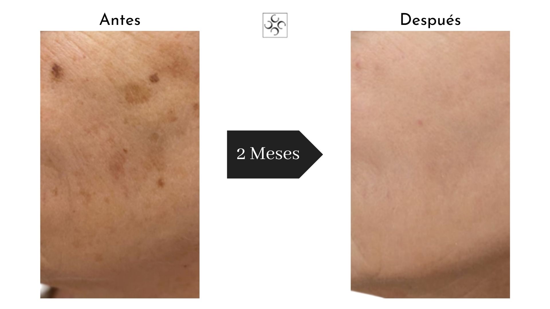 Antes y después · Manchas