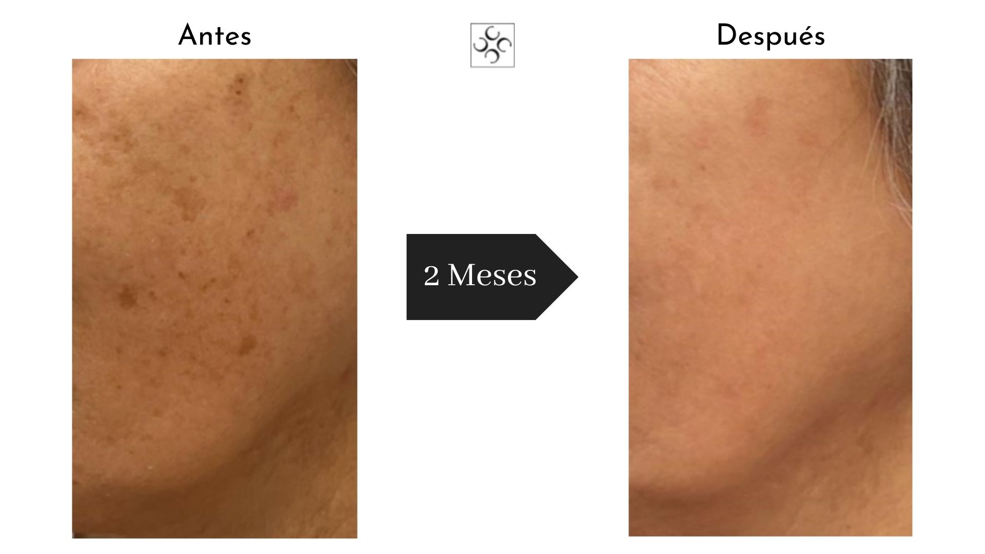 Antes y después · Manchas