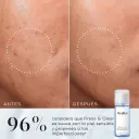 Press & Clear de la marca MEDIK8: Resultados