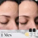 Oxy-R Peptides de la marca MEDIK8: Resultados