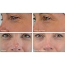 Crystal Retinal 10 de la marca MEDIK8: Resultados visibles 2