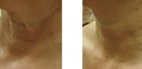 HarmonyXL Pro-Q-SwitchedElektra Cuello