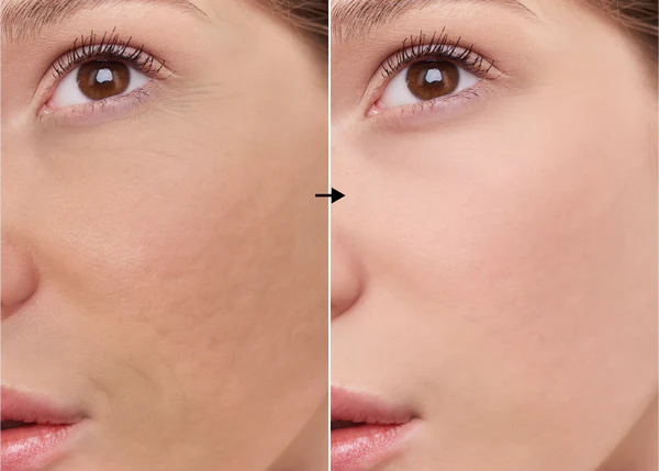 L-ascórbico (vitamina C) 7% de la marca Universkin: Resultados