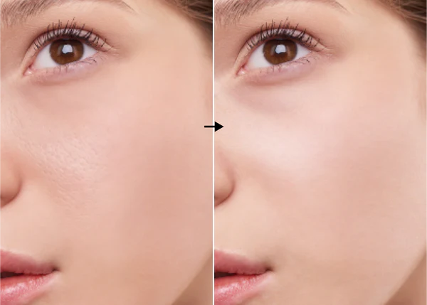 Zinc 5% de la marca Universkin: Resultados