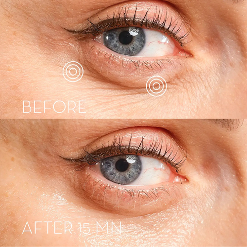 Eye Precision Mask Pack de 6