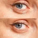 Eye Precision Mask Pack de 6