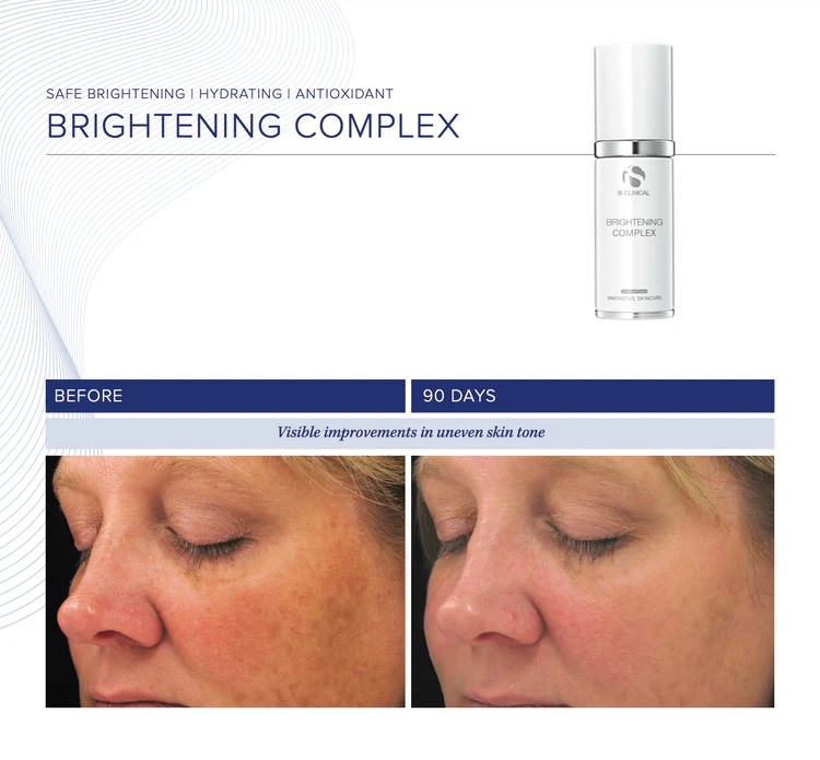 Brightening Complex de la marca Is Clinical: Resultados visibles en apenas 90 dias