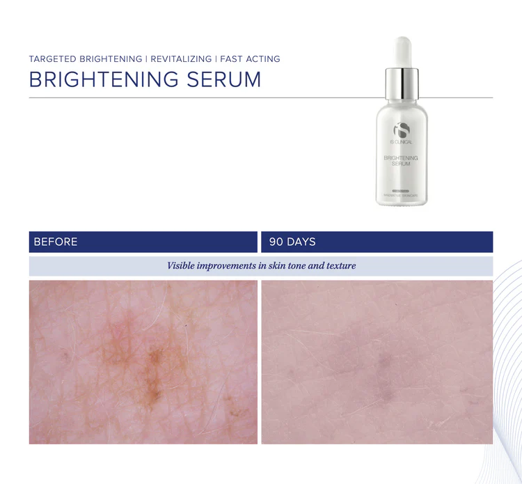Brightening Serum de la marca Is Clinical: Resultados visibles en apenas 90 dias