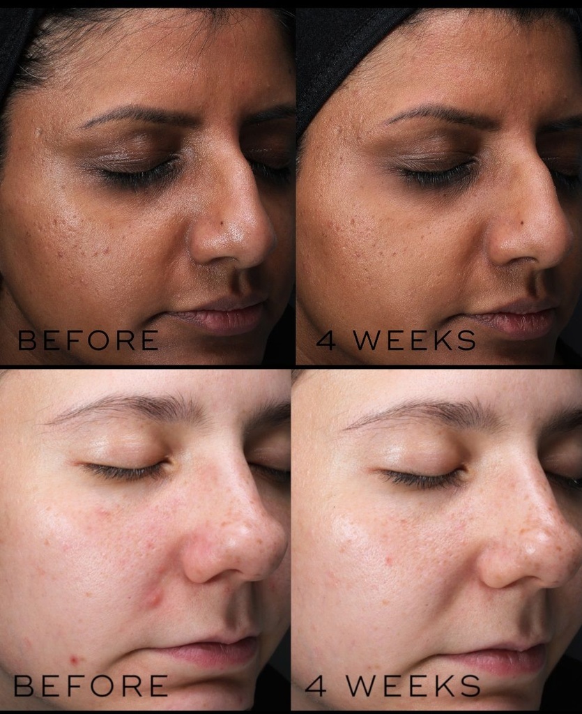 Clarity Peptides