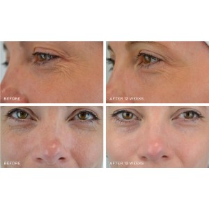 Crystal Retinal 10