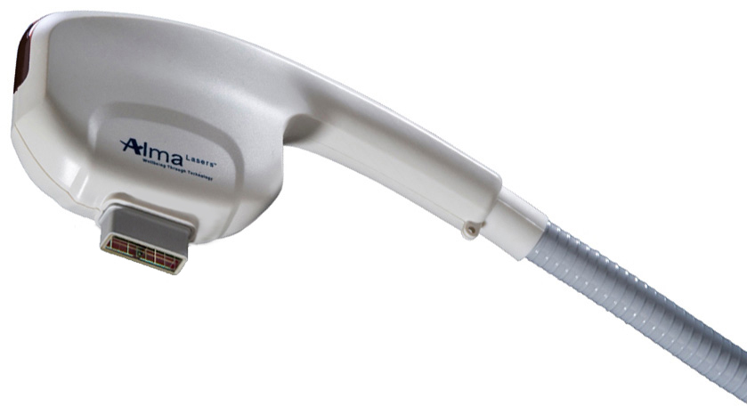 Depilación Alma Láser SHR Piernas Completas