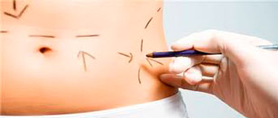 [666666-43] Corporal - Pre/Post cirugía estética