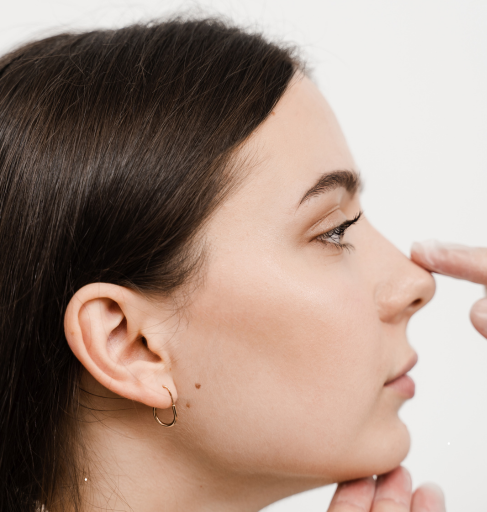 Remodelación de la nariz con implantes - Reabsorbibles