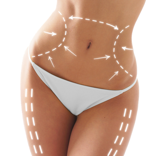 Corporal - DLM Brasileño+Venus Legacy Bono 6 sesiones